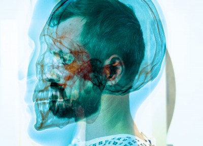 Innovative film marks 120th anniversary of the first medical X-ray