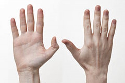 Finger length may show you should be an entrepreneur, says study
