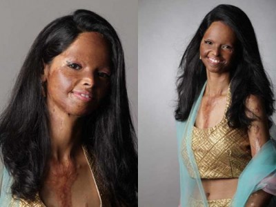 Women acid attack survivors walk the ramp for Womenâ€™s Day celebration