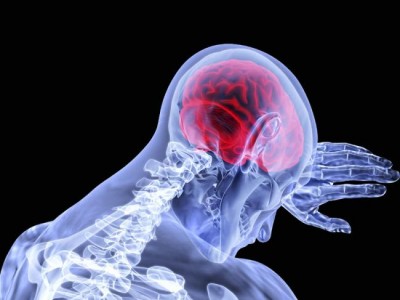 Stroke doubles dementia risk, concludes large-scale study