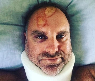 Ex- Australian opening batsman Matthew Hayden fractures spine in surfinf accident