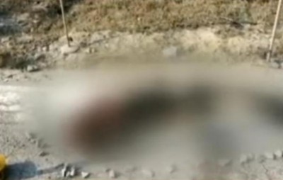 Uttar Pradesh: Unnao rape survivor burnt, in critical condition