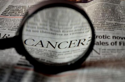 Testosterone slows prostate cancer recurrence in low-risk patients: Study
