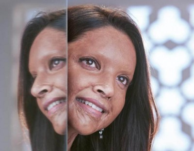 Netizens slam actress Deepika Padukone for turning her Chhapaak 'look' into a TikTok challenge  