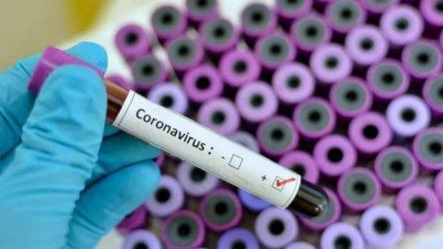 Uttar Pradesh: Woman journalist tests positive for Covid-19Â 