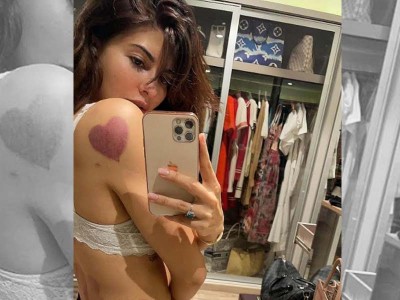 Jacqueline Fernandez 'hooked' to cupping therapy
