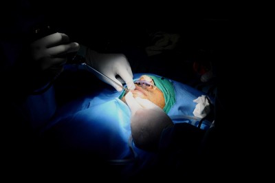 View of ENT specialists operating on Black Fungus Patient