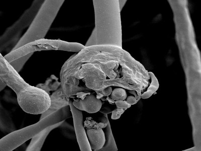 Homeopathic treatment protocol can treat Black Fungus attack, says homeopath Dr Samit Ghosh