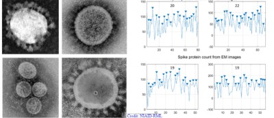 IIT Kharagpur model shows SARS-CoV-2 alters lung cell metabolism, could help therapeutics