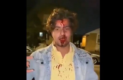 Hyderabad student injured after being chased and attacked by four men in Chicago, phone stolen